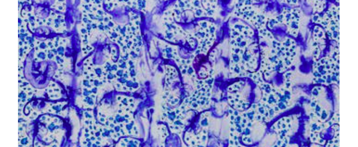 Barthélémy TOGUO présente "Déluges" au Carré Sainte-Anne